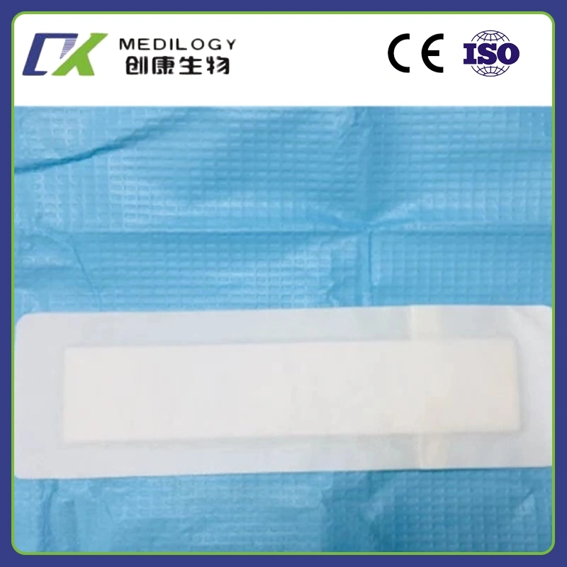 Factory Supply Surgical Self-Adhesive Non-Woven Bordered Gauze Island Dressing Wound Care with Absorbent Pads